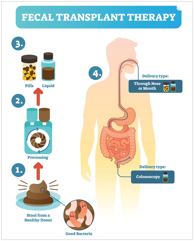 Scientist are in the early stages of testing fecal transplants for mood disorders. Stay tuned. 
