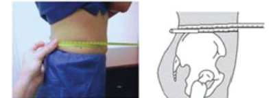 As your waist expands, so does your risk of diabetes.