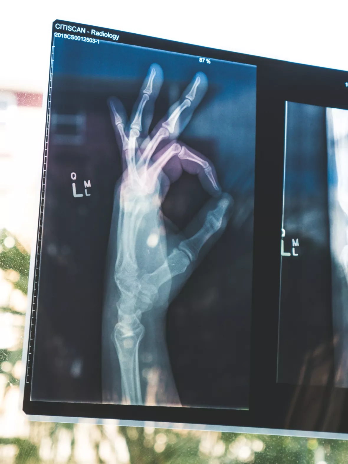 xray