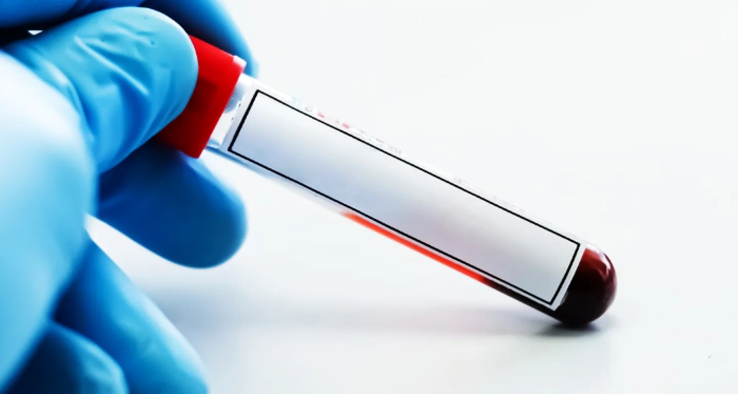 gloved hand holding a vial of blood