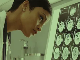 doctor looking at brain scans in lab