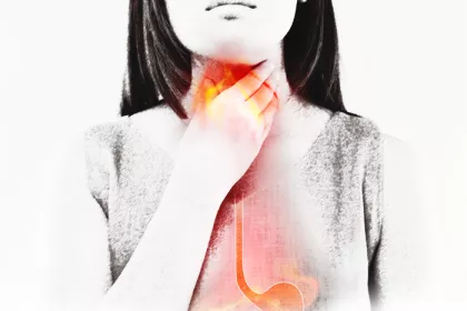 illustration of GERD