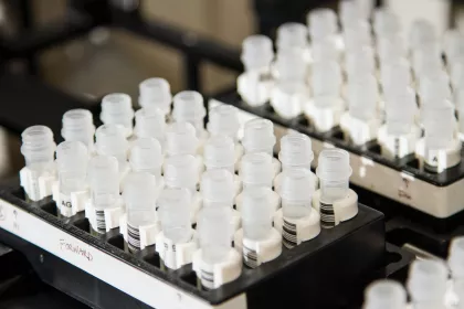 A tray of small plastic test tubes