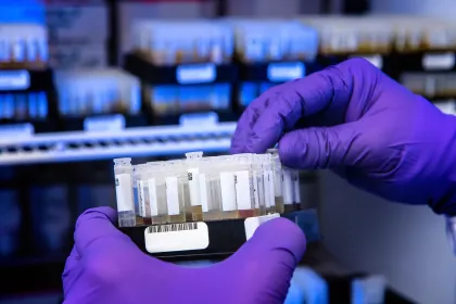 Lab Test