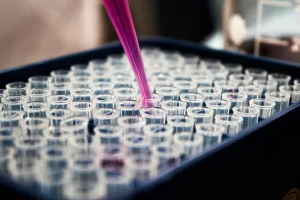 Person putting a drop in a test tube