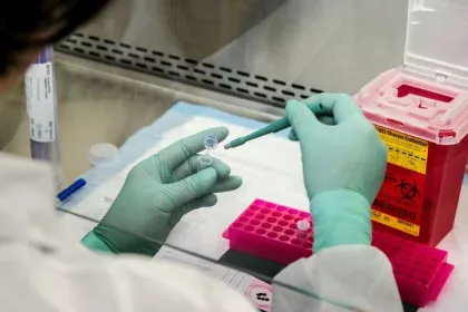 CDC scientist prepares biopsy sample for molecular testing in laboratory