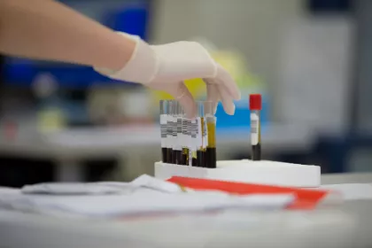 holding test tube