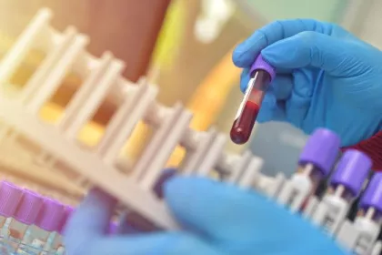 Lab sample testing; laboratory-developed tests (LDTs) are unregulated by FDA, leading to unreliable results and the risks of false positives or negatives.