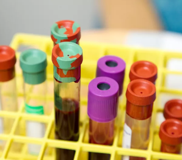 Test tubes filled with blood