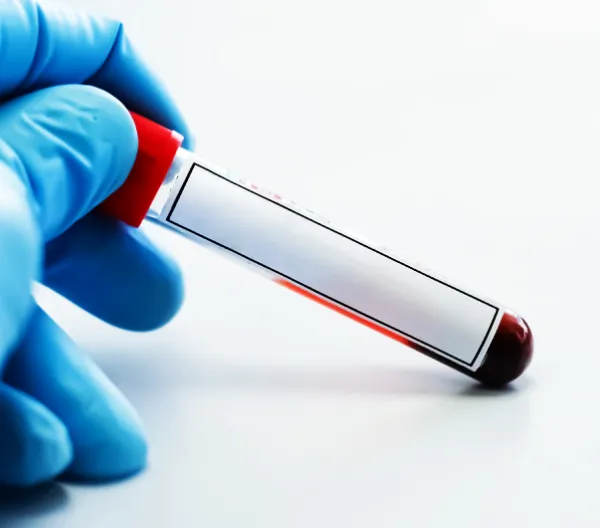 gloved hand holding a vial of blood