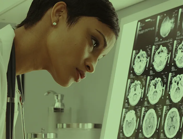 doctor looking at brain scans in lab
