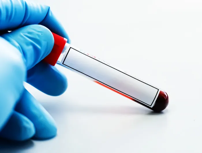 gloved hand holding a vial of blood