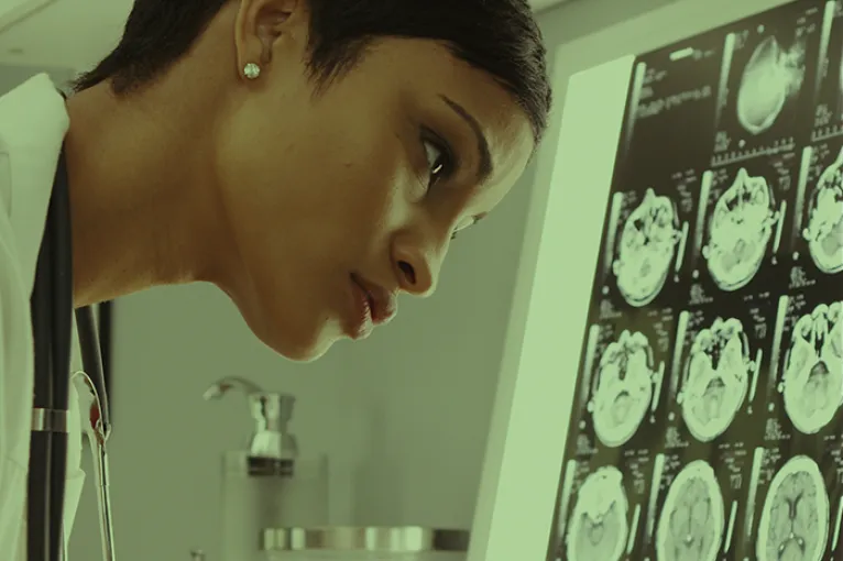 doctor looking at brain scans in lab