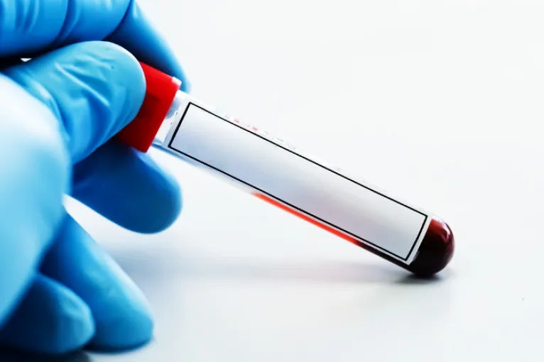 gloved hand holding a vial of blood