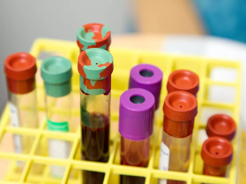 Test tubes filled with blood