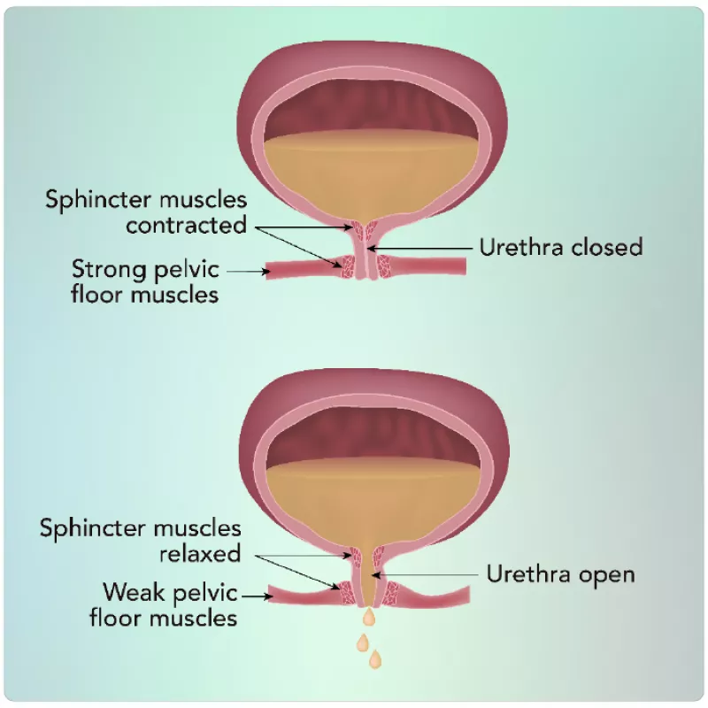 illio of pelvic floor and bladder control