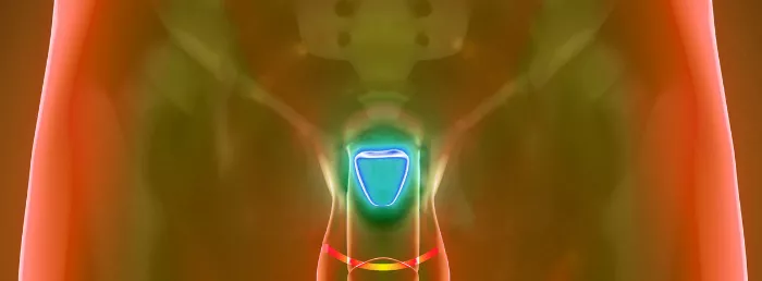 prostate cancer