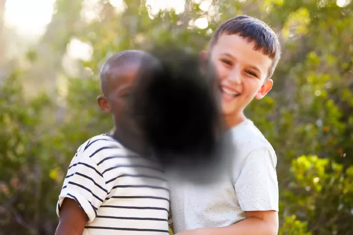 macular degeneration