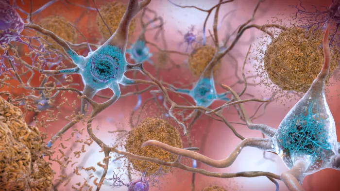 tau and beta amyloid