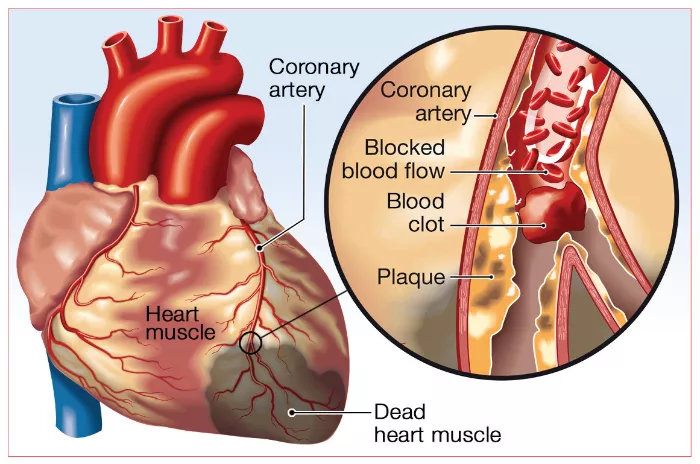 diagram of heart