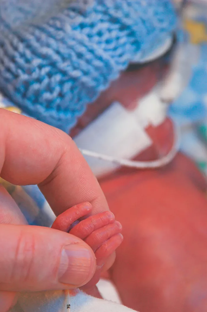premature baby in the hospital NICU