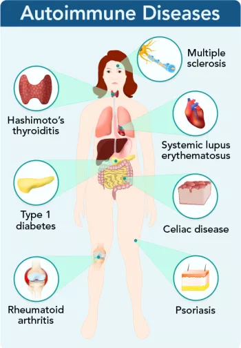 autoimmune diseases diagram
