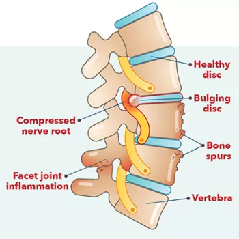 back diagram