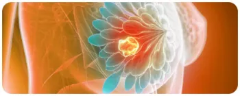 colorful diagram of the breast