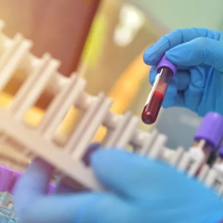 Lab sample testing; laboratory-developed tests (LDTs) are unregulated by FDA, leading to unreliable results and the risks of false positives or negatives.