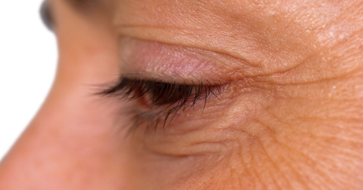 Do collagen supplements improve wrinkles?
